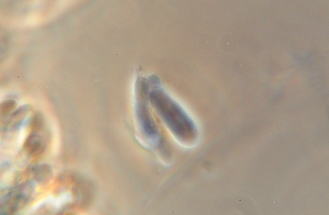 Crosta chiara su faggio - foto 4927 (Mycoacia aurea)